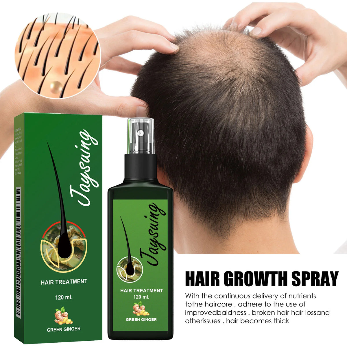 Ginger Hair Growth Serum Spray Scalp Treatment Nourish Hair Root Strengthen Prevent Loss Repair Follicle Smooth Essence Nutrient
